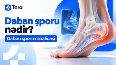 daban şporu müalicəsi